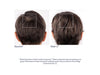 Obagi Nu-Cil™ BioStim Scalp Serum