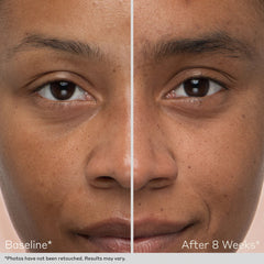 Obagi Nu-Cil Duo (Worth $265.00)