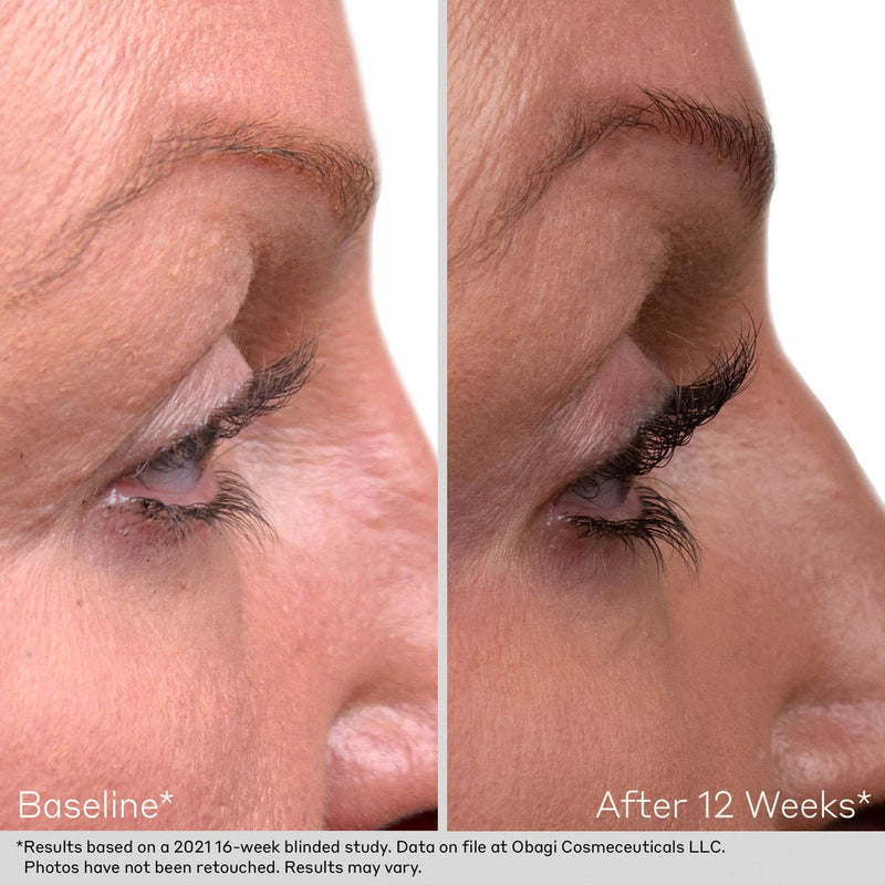 Obagi Nu-Cil Duo (Worth $265.00)