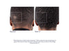 Obagi Nu-Cil™ BioStim Scalp Serum