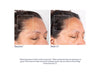 Obagi Nu-Cil™ BioStim Scalp Serum