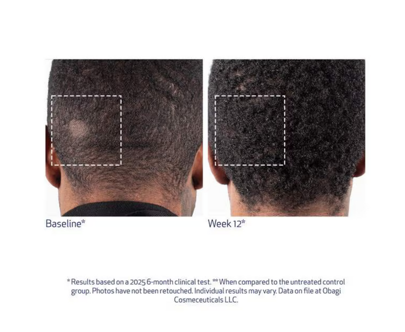 Obagi Nu-Cil™ BioStim Scalp Serum