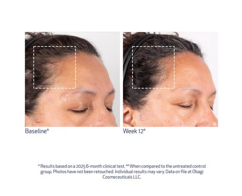 Obagi Nu-Cil™ BioStim Scalp Serum