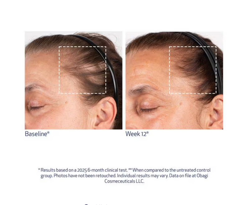 Obagi Nu-Cil™ BioStim Scalp Serum