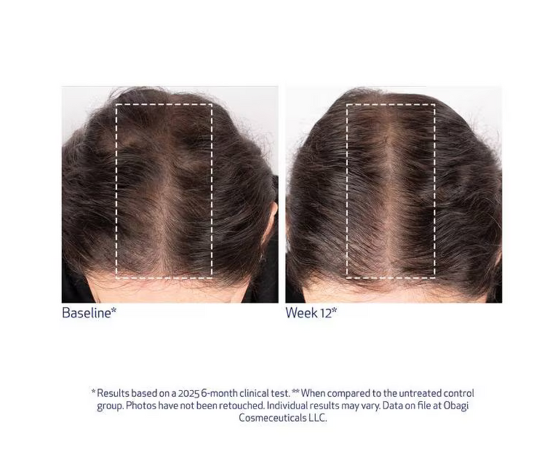 Obagi Nu-Cil™ BioStim Scalp Serum