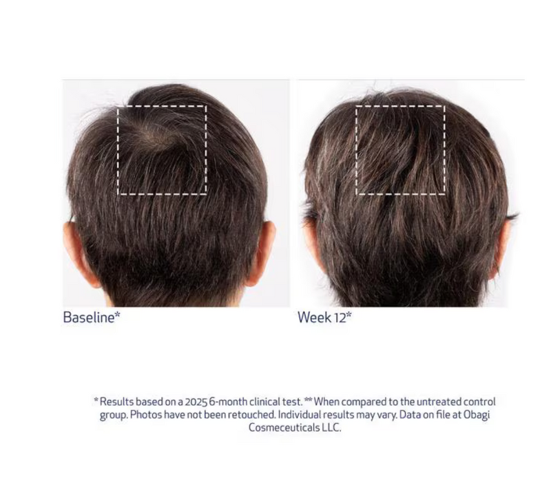 Obagi Nu-Cil™ BioStim Scalp Serum