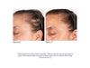 Obagi Nu-Cil™ BioStim Scalp Serum