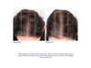 Obagi Nu-Cil™ BioStim Scalp Serum